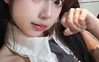 First Image